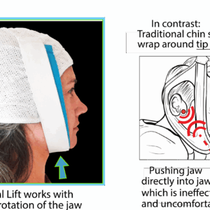 Knightsbridge Dual Band Chin Strap cpap store usa 4 scaled