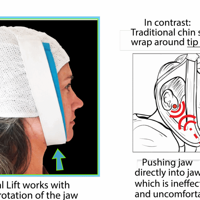 Knightsbridge Dual Band Chin Strap cpap store usa 4 scaled