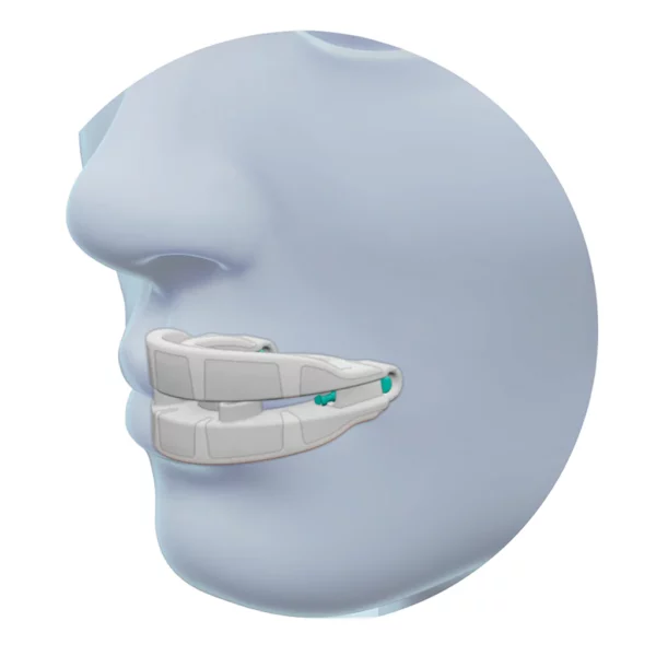 snore-logic-mouth-guard-cpap-store-usa-anti-snoring
